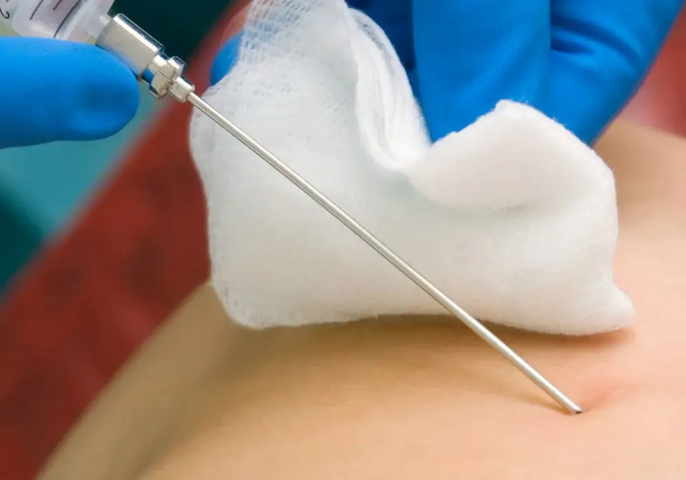 Czy miesiączka jest przeciwwskazaniem do biopsji? Ważne informacje