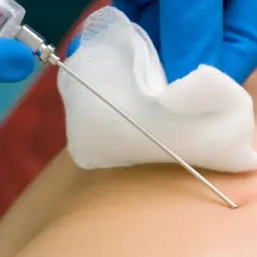 Czy miesiączka jest przeciwwskazaniem do biopsji? Ważne informacje