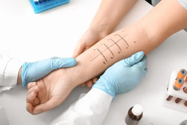 Immunoterapia alergenowa - czy to leczenie dla Ciebie?